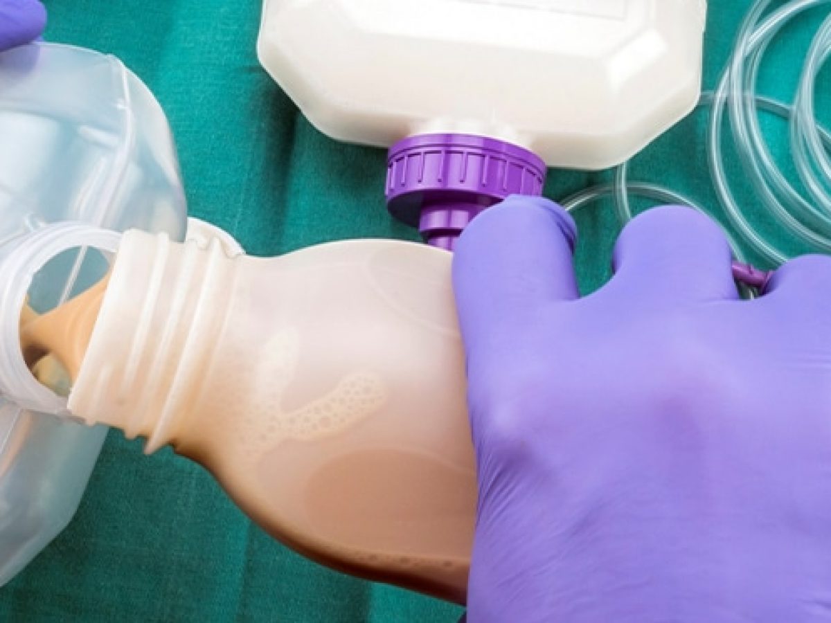 Enteral Feeding Services