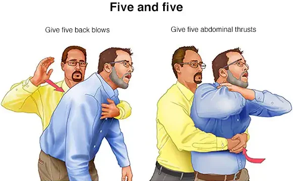 Choking Care Services