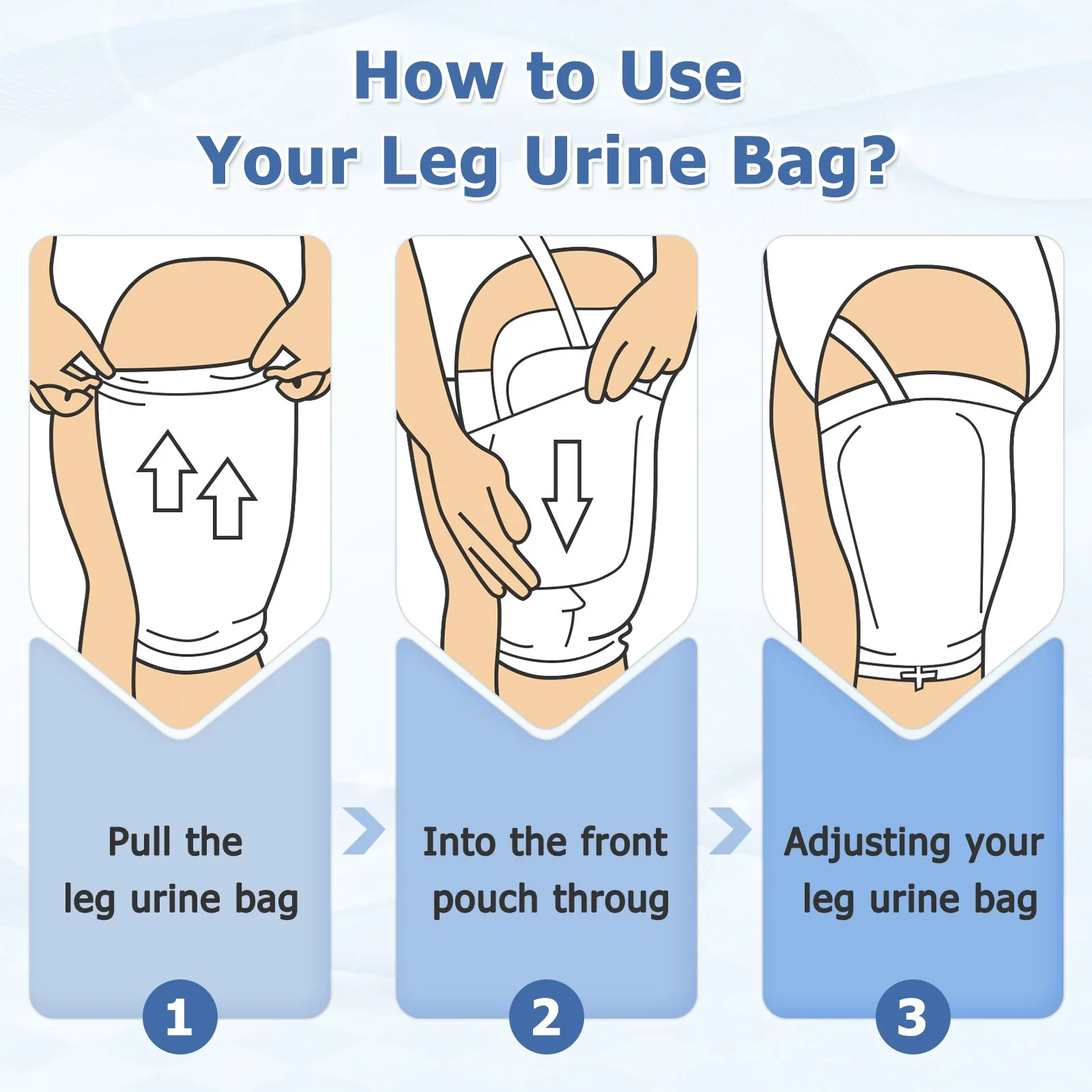 Urine Catheter Management